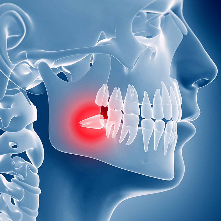 TMJ Treatment